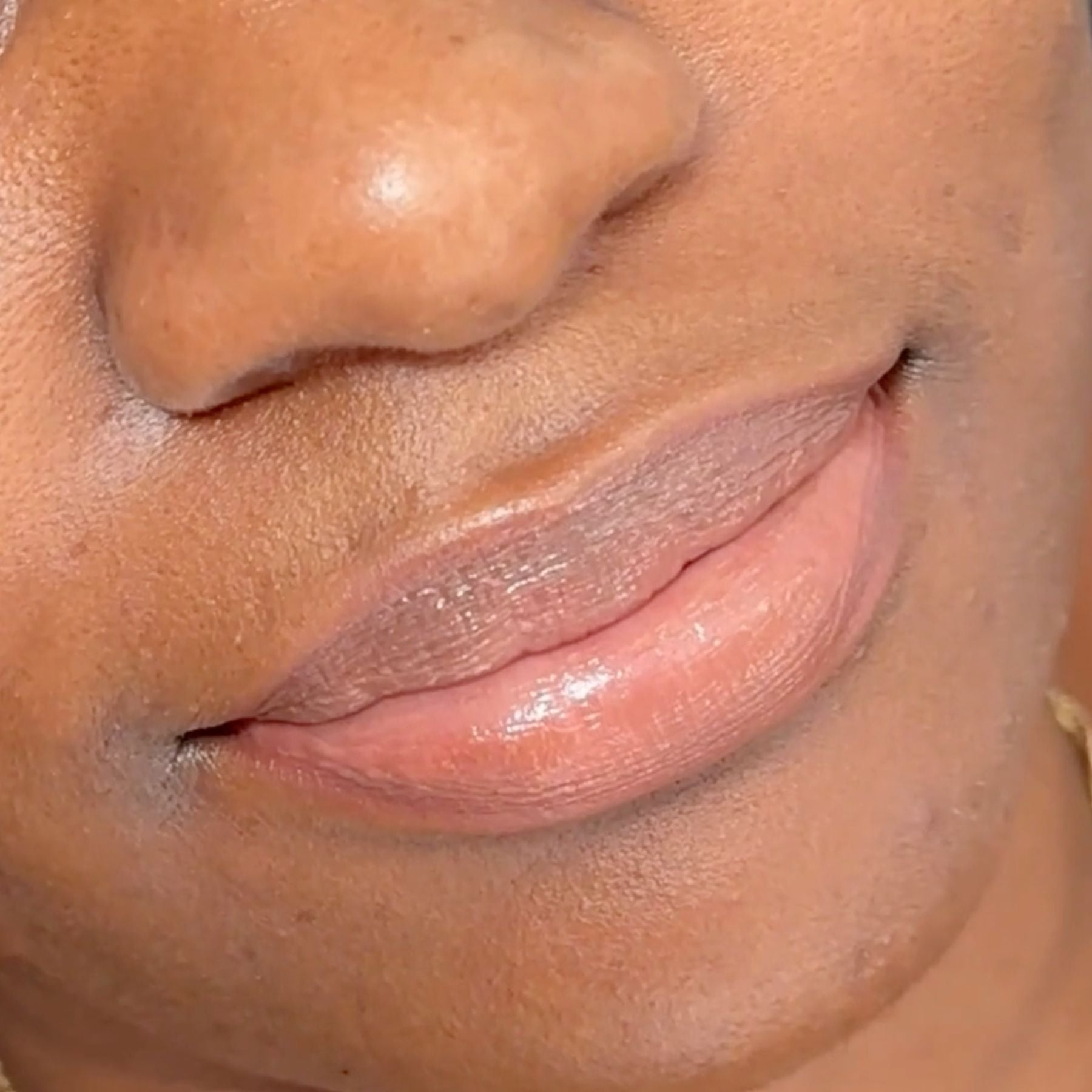 Fitz 6 Dark Lip Neutralization: Kurty’s Case Study by Amanda Rakhra