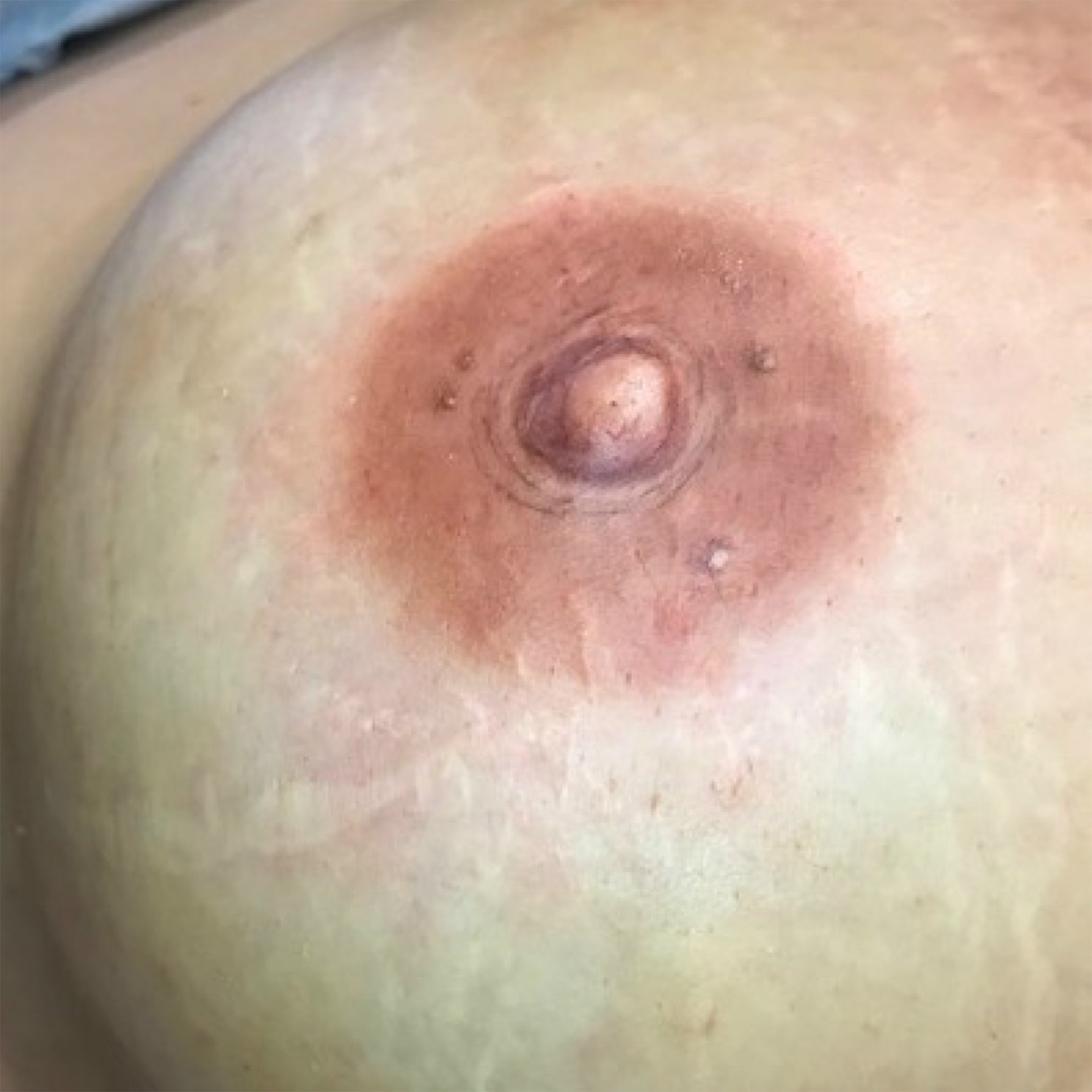 3D Areola Tattooing by Terry Lively