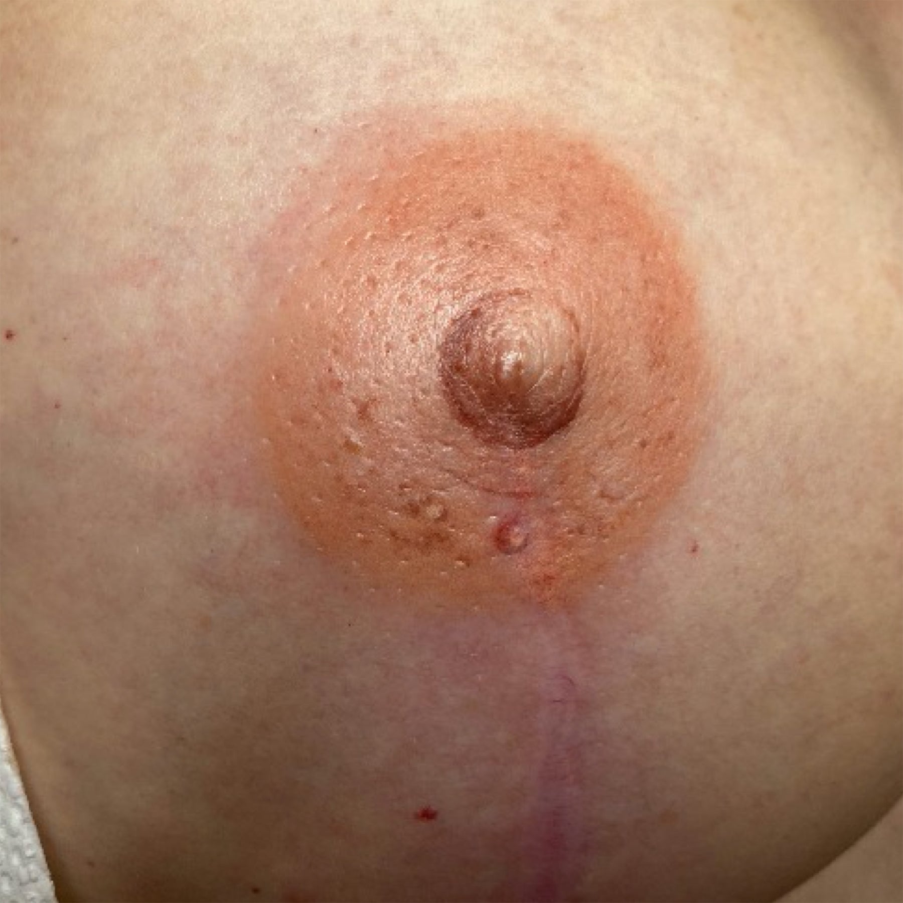 3D Areola Tattooing by Terry Lively