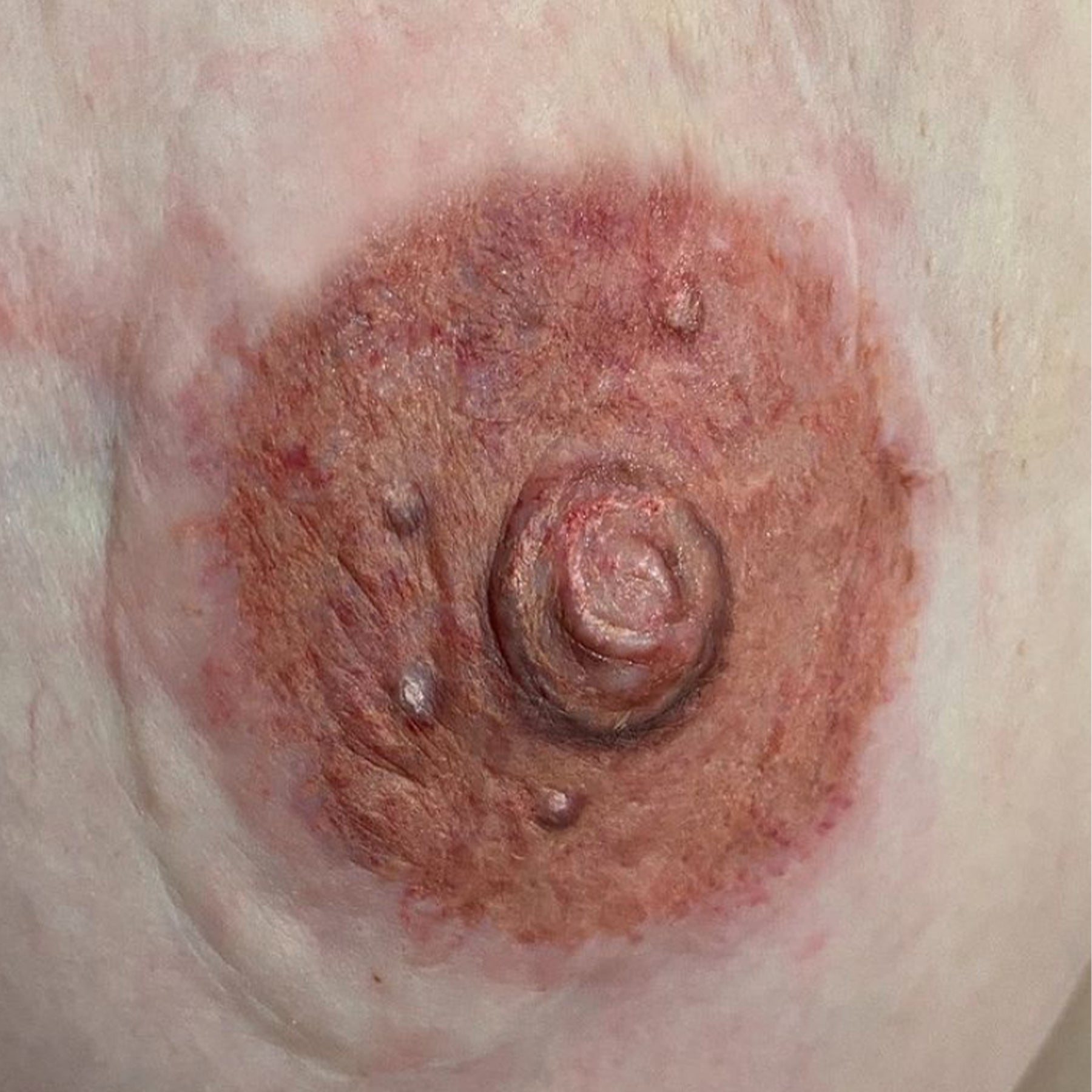 3D Areola Tattooing by Terry Lively